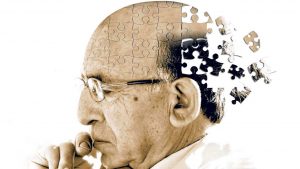 otępienia - choroba Alzheimera